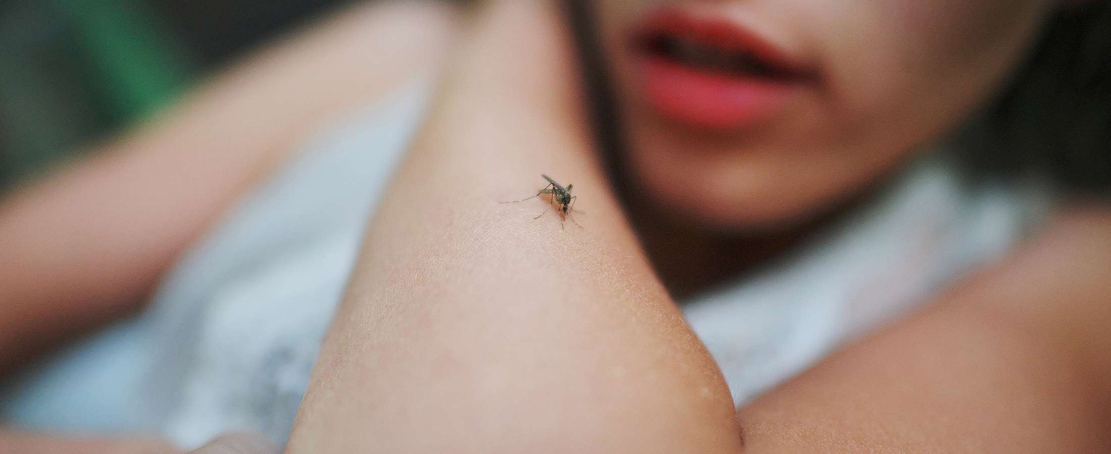 Bug Bites and Stings