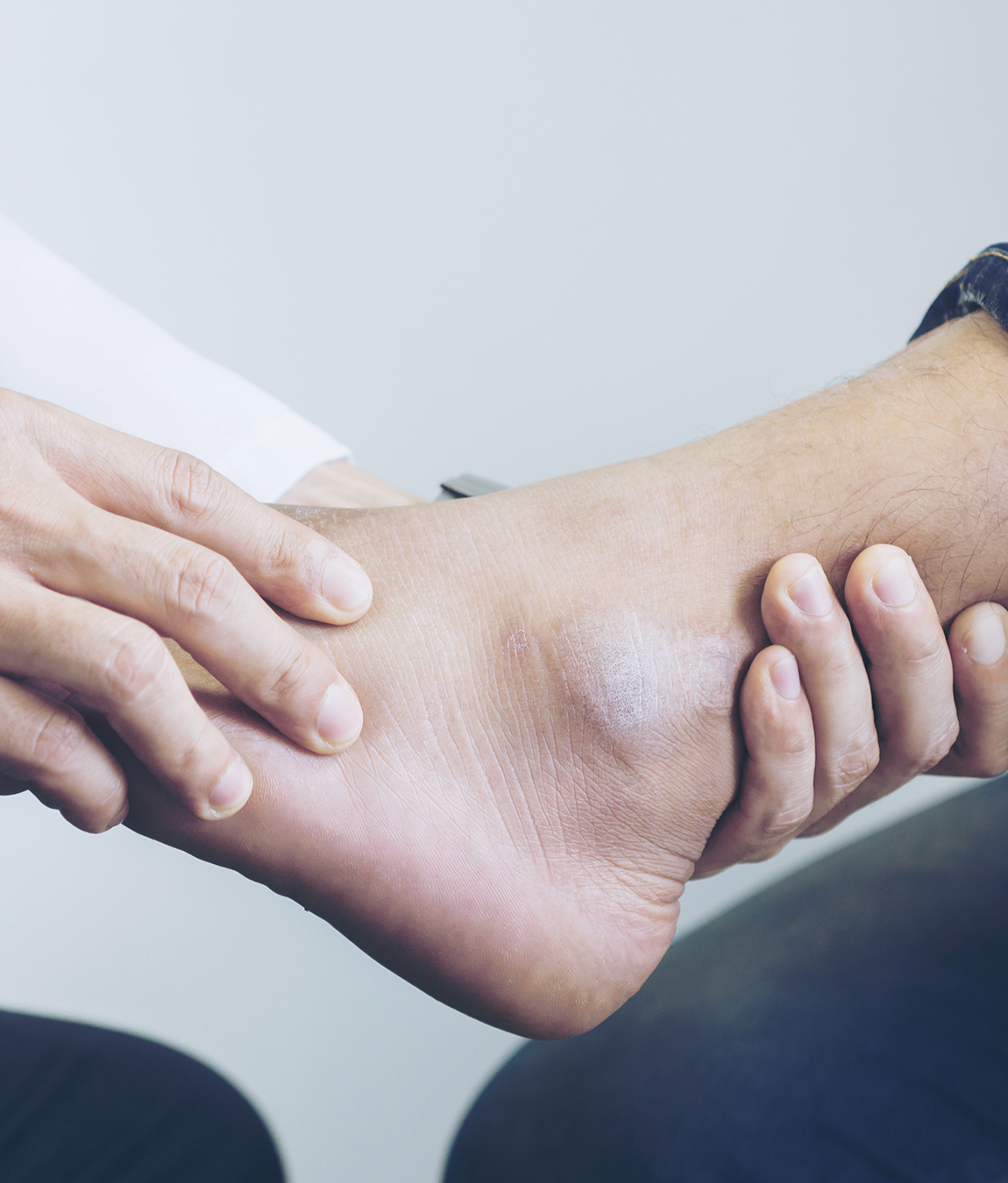 Doctor assessing a sprained ankle