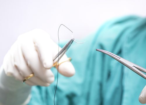 Suture and staple removal